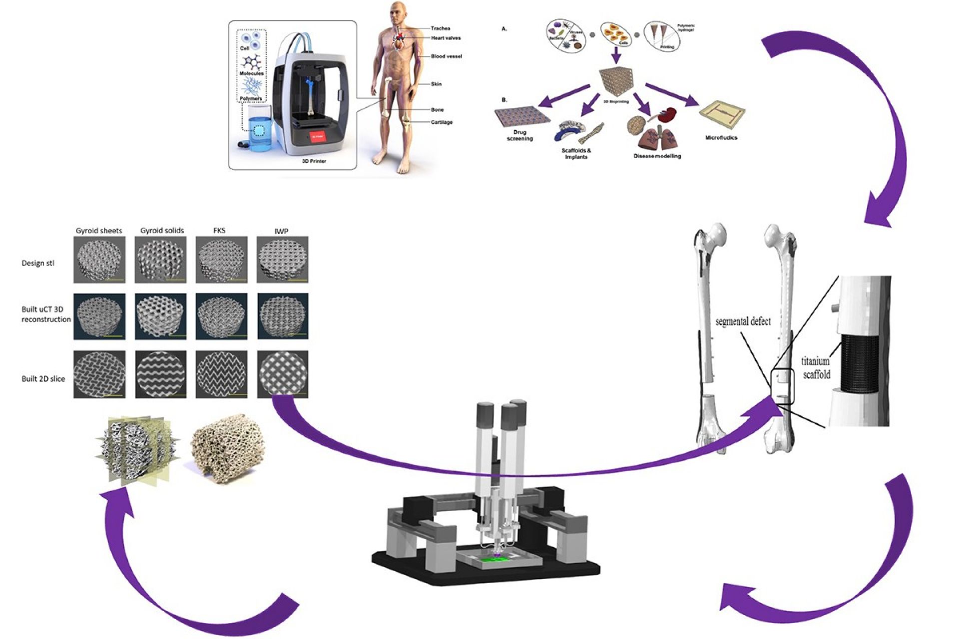 Custom 3D-Printed TPMS-Based Bone Implants